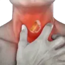 اسٹیکر